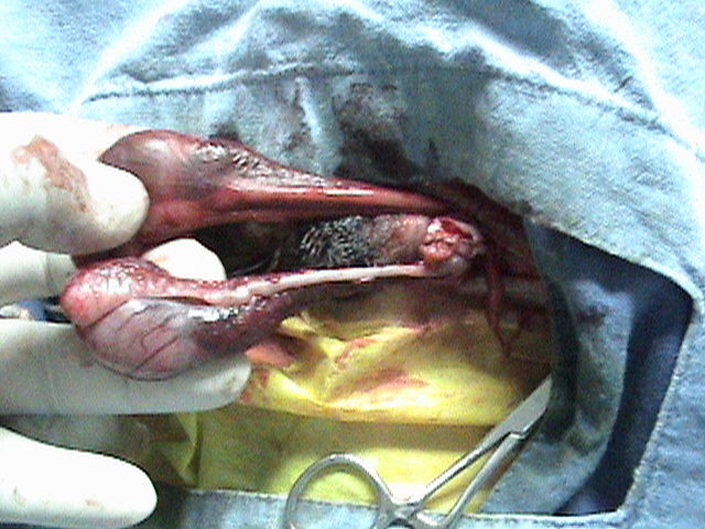 Se extrae el segundo testículo